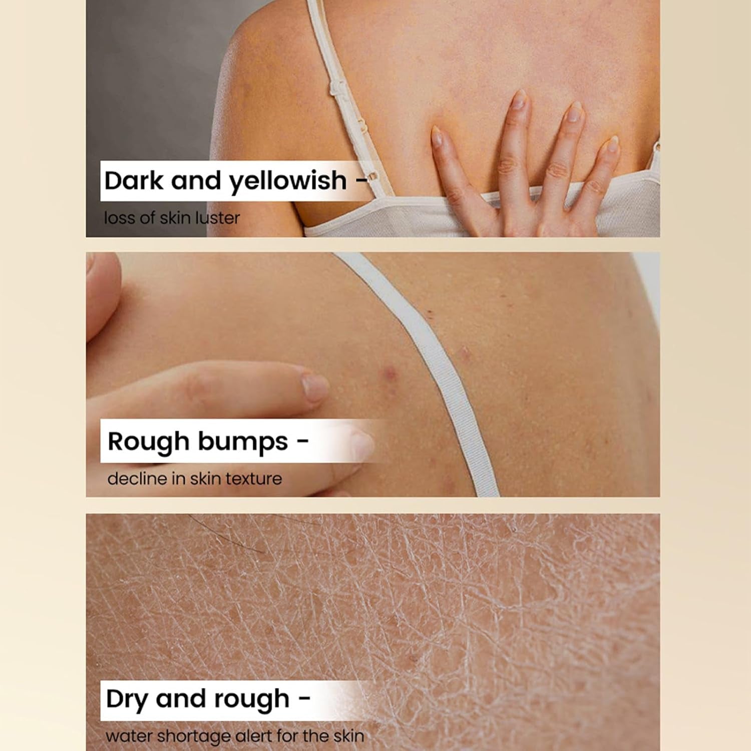 Glycolic Acid Exfoliating Body Stick,Exfoliating Lotion Stick,Smooths Rough Skin,Reduces the Appearance of Cellulite,Effect Radiant Skin,Bodycare Balm for Underarms,Legs,Body /2.65 Oz